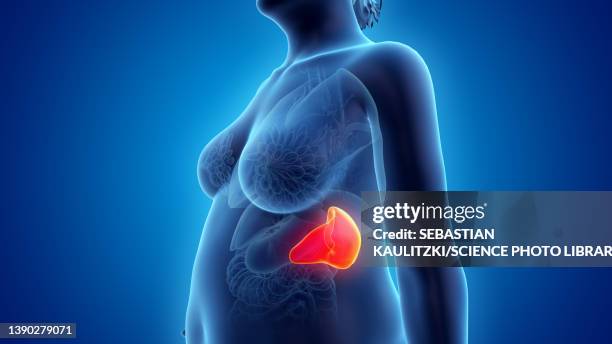 obese woman's spleen, illustration - spleen stock illustrations