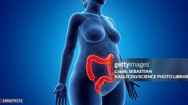 obese woman's colon, illustration - sigmoid colon stock illustrations