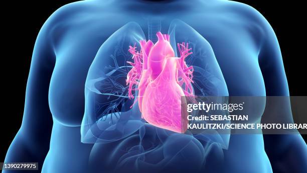 bildbanksillustrationer, clip art samt tecknat material och ikoner med obese man's heart, illustration - heart ventricle