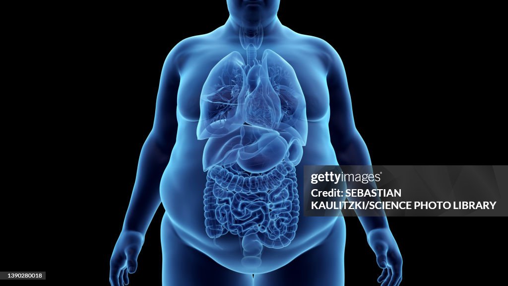 Obsite Humain Obese Mans Organs Illustration High-Res Vector Graphic - Getty Images