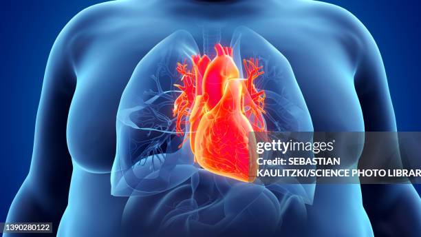 bildbanksillustrationer, clip art samt tecknat material och ikoner med obese man's heart, illustration - heart ventricle