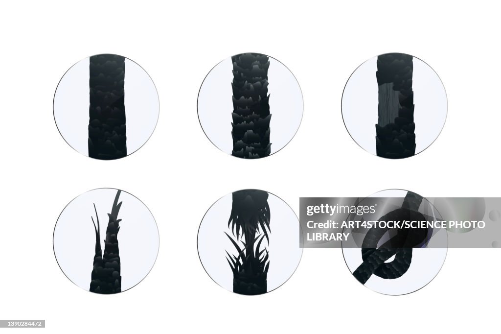Hair damage types, illustration