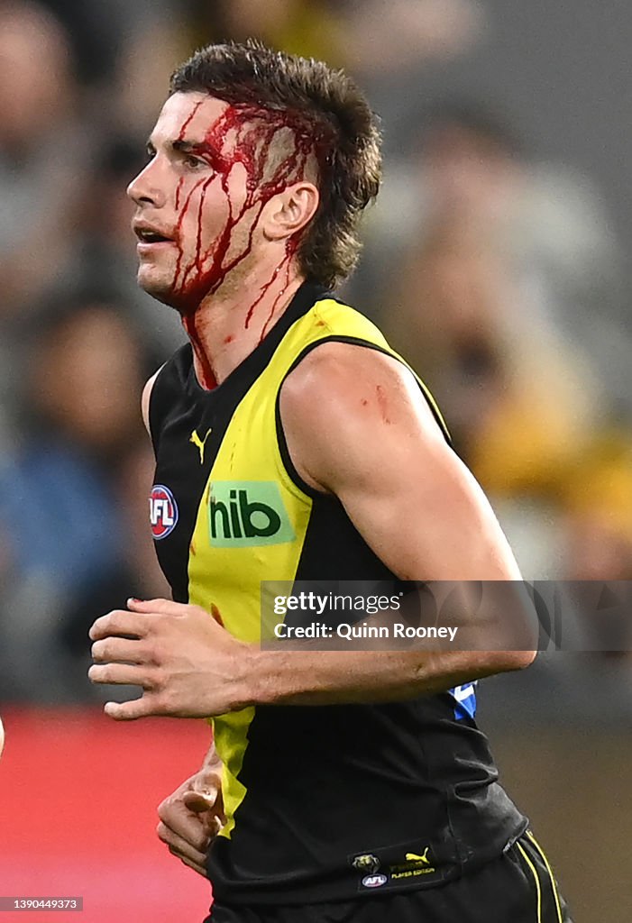 AFL Rd 4 - Richmond v Western Bulldogs