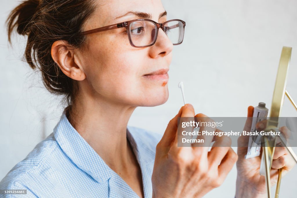 A woman looking her face in a mini mirror before applying an antiviral cream or ointment to treat Herpes labialis on her lower lip.