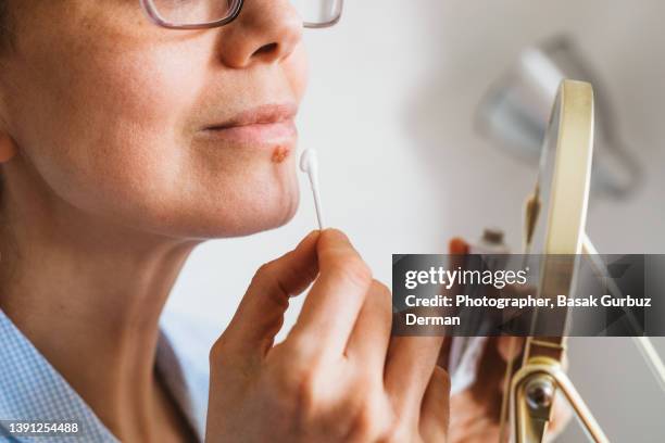 a woman looking her face in a mini mirror before applying an antiviral cream or ointment to treat herpes labialis on her lower lip. - cold sore stock pictures, royalty-free photos & images