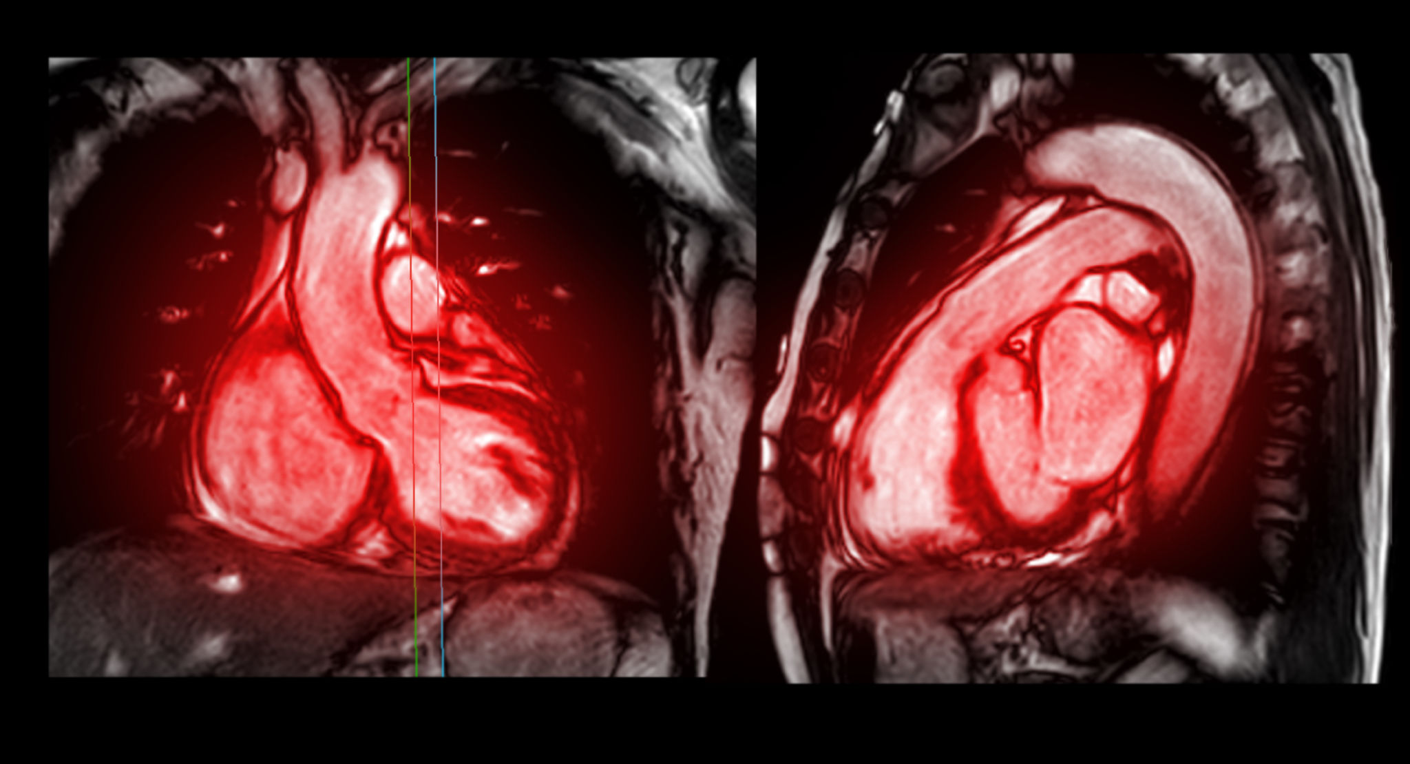 cardiac imaging
