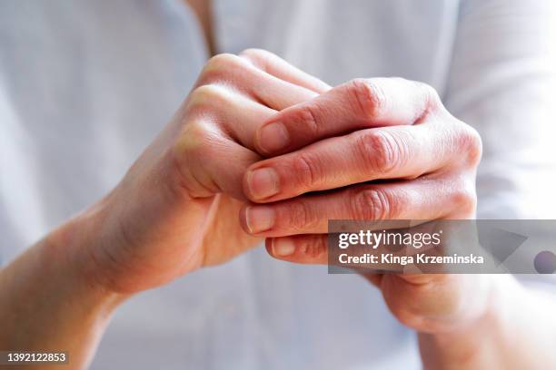 hands - artrite foto e immagini stock