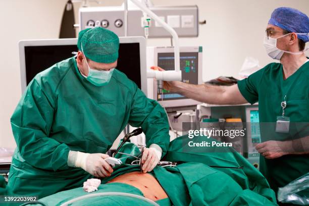 male surgeons performing gastric bypass surgery - hecht stockfoto's en -beelden