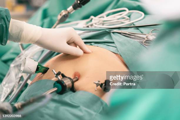 surgeons performing bariatric surgery - laparoscopy stock pictures, royalty-free photos & images