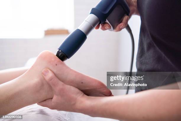 female physiotherapist doing shockwave treatment neurological hammer massage foot massage - shockwave therapy stock-fotos und bilder
