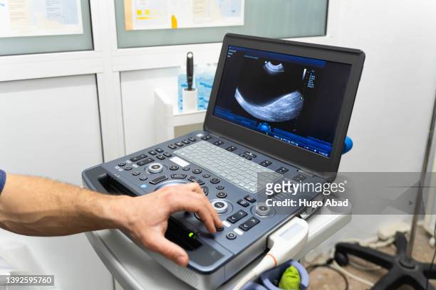 monitor reflecting ultrasound images. - radiographer stock pictures, royalty-free photos & images