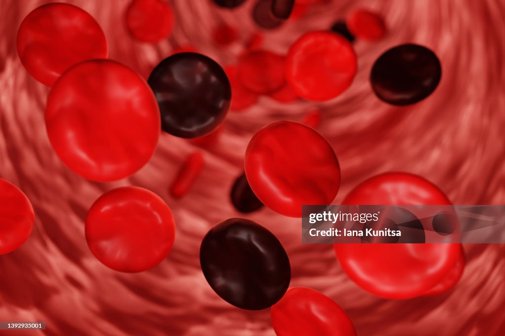 Red and black blood cells flowing through artery. Cholesterol and blood diseases concept. 3D.