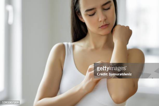 young woman scratching her arm - mosquito stock pictures, royalty-free photos & images