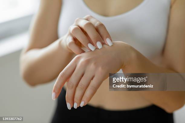 rascándose la mano con las uñas - psoriasis fotografías e imágenes de stock