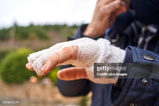 close-up view of man with fractured hand, covered with gauze and immobilized, dressed in jacket on a sunny day outside. - bandaged thumb stock pictures, royalty-free photos & images