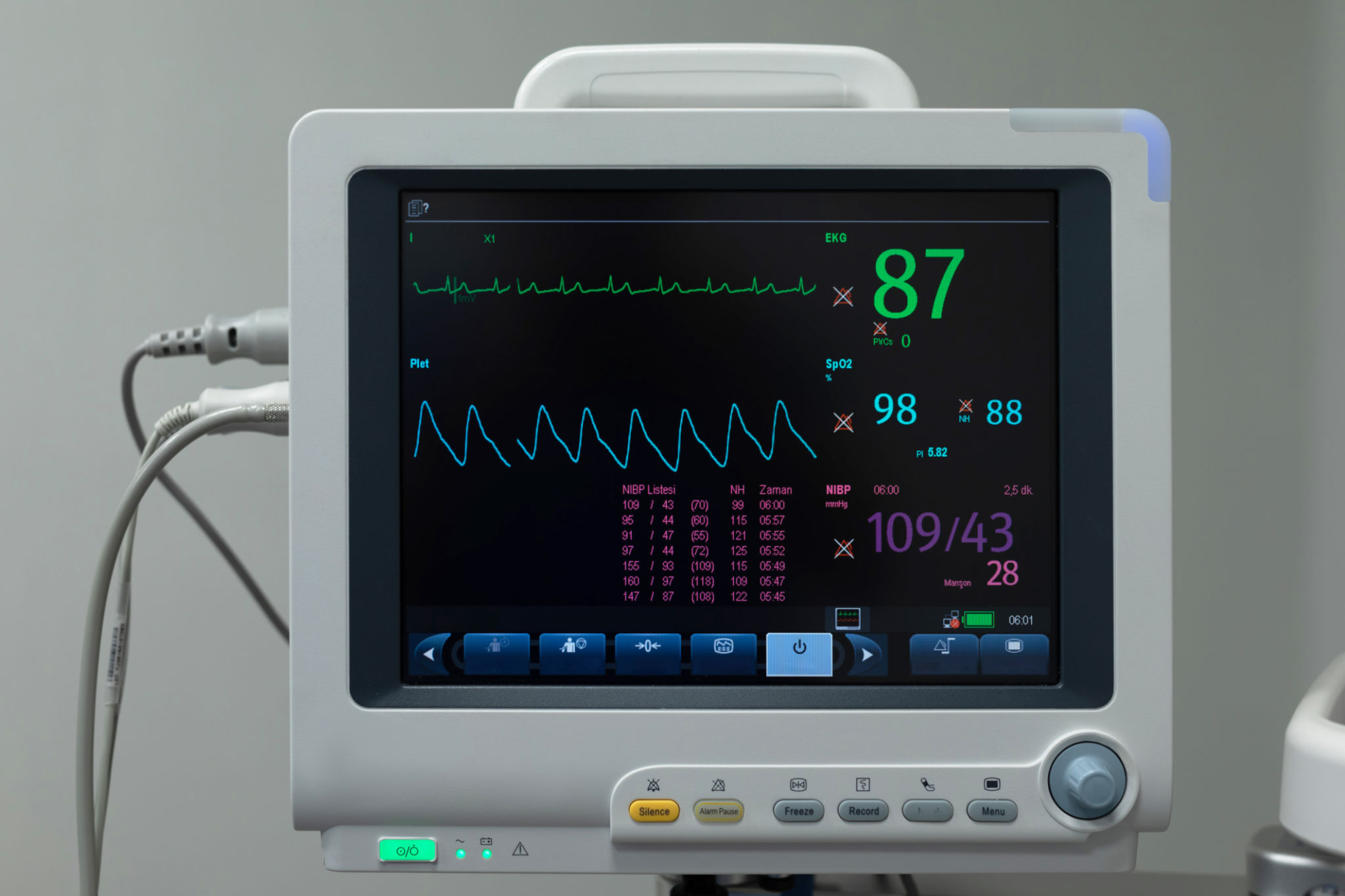 patient safety monitoring