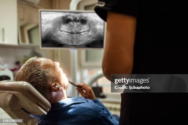 dentist explaining tooth x-rays to a patient. - dental equipment stock pictures, royalty-free photos & images