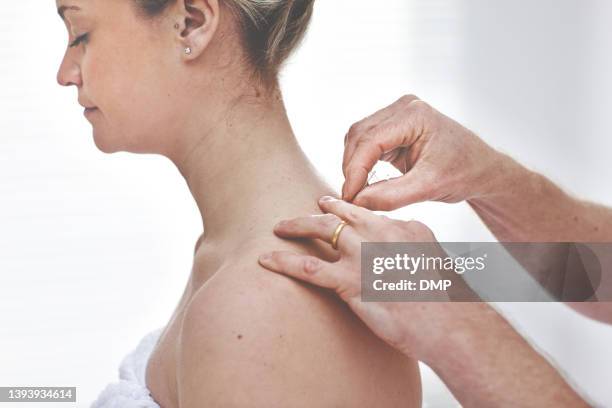 a young woman getting needles inserted into her back during an acupuncture session. a patient getting alternative therapy for medical treatment - needle injury stock pictures, royalty-free photos & images