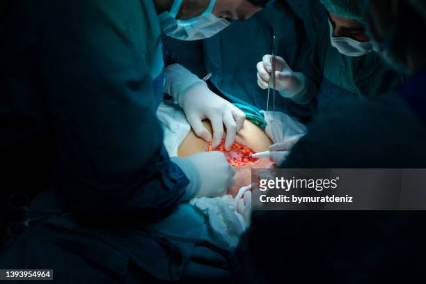 operation in hospital - operating gown stock pictures, royalty-free photos & images
