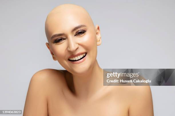 portrait of young woman with hair loss from treatment, posing happiness after beating cancer. - haarloos stockfoto's en -beelden