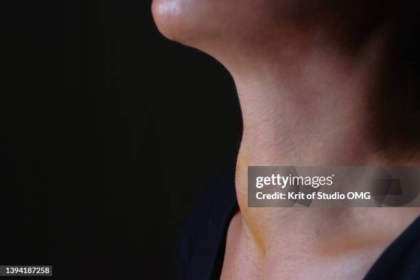 swelling of the lower throat cause thyroid nodule - gola foto e immagini stock