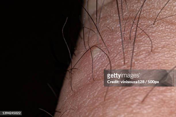 inflammation caused by ingrown hair,close-up of man with hearing aid - ingrown hair stock pictures, royalty-free photos & images