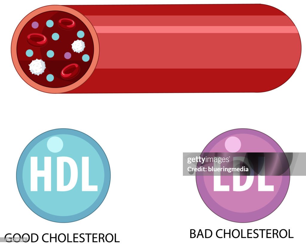 2 Types Ldl Types Of Cholesterol Hdl And Ldl High-Res Vector Graphic - Getty Images