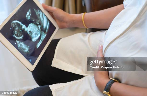 pregnant woman showing ultrasound image on digital tablet - foetus stock pictures, royalty-free photos & images