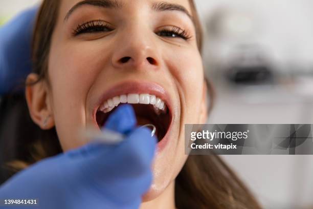 getting her teeth checked - cleaning imagens e fotografias de stock