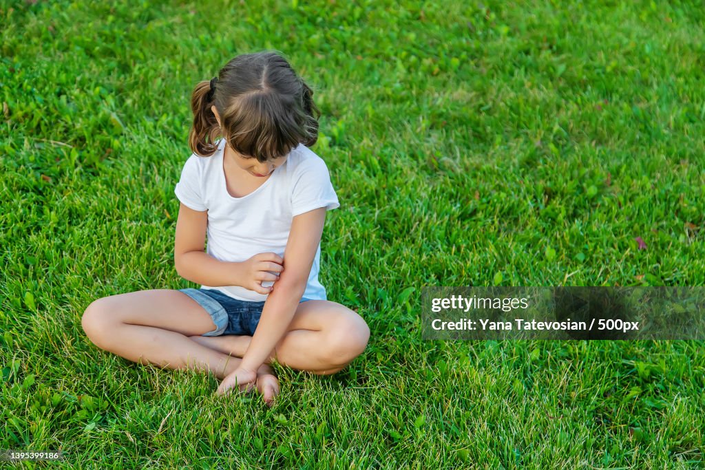 Child is bitten by mosquitoes Selective focus