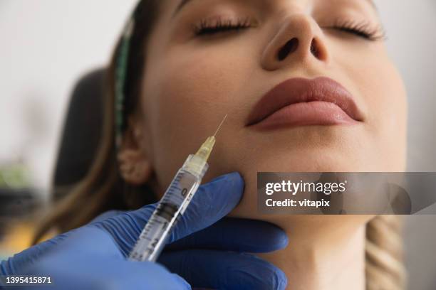 dermal filler - aesthetics treatment - beauty treatment stock pictures, royalty-free photos & images