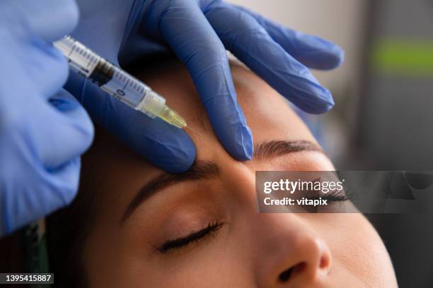 trattamento con botox - iniezione di botulino foto e immagini stock