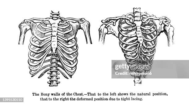 Twisted Rib Vs Normal Rib Rib Diagram Fotografías e imágenes de stock - Getty Images