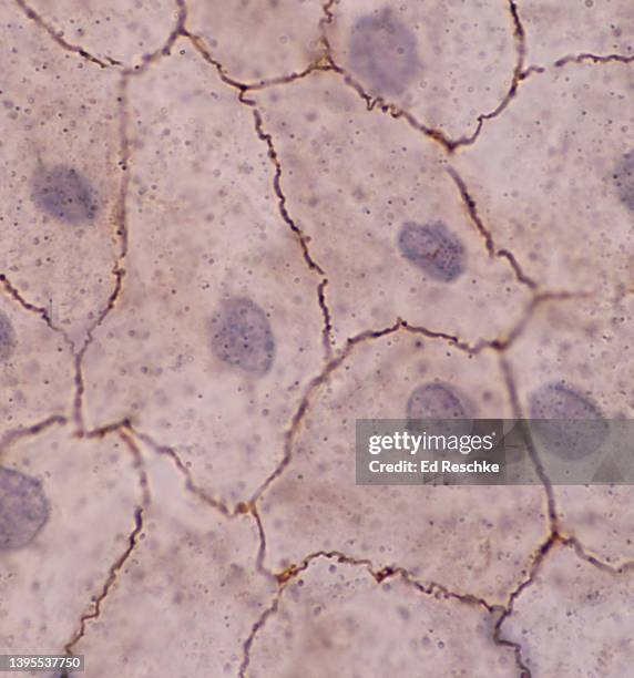 mesothelium (or simple squamous epithelium or pavement epithelium) peritoneum, 400x - simple squamous epithelium fotografías e imágenes de stock