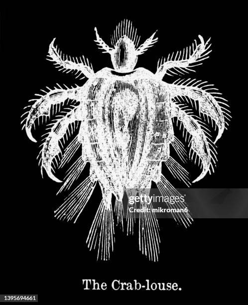 41 Pubic Crabs Stock Photos High Res Pictures And Images Getty Images 41-pubic-crabs-stock-photos-high-res-pictures-and-images-getty-images