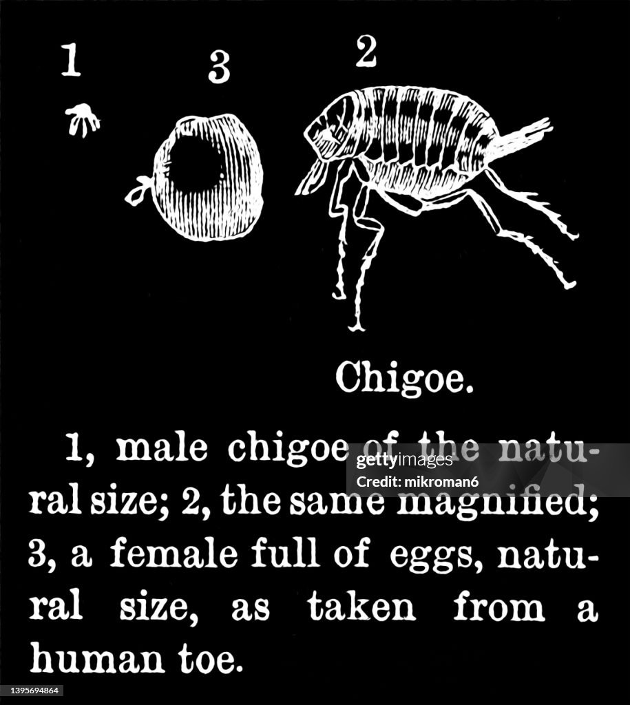 Old engraved illustration of jigger, jigger flea, chigoe, chigo, chigoe flea, chigo flea, nigua, sand flea, or burrowing flea (Tunga penetrans)