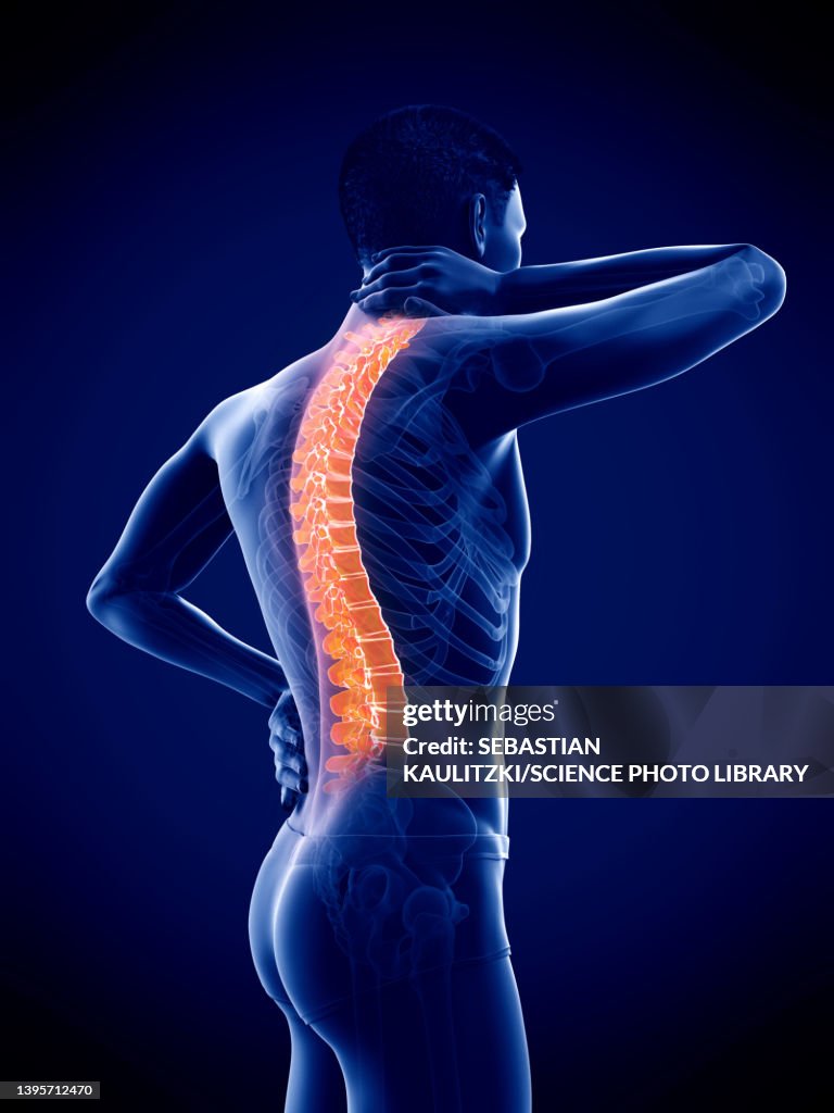 Bckche Man With Backache Illustration High-Res Vector Graphic - Getty Images