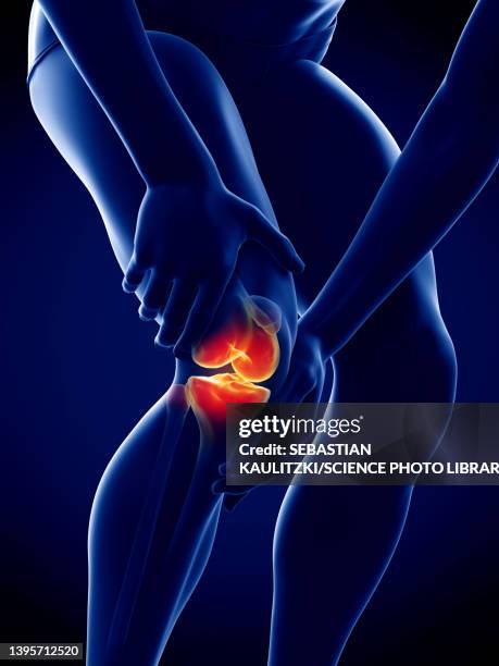 illustrations, cliparts, dessins animés et icônes de painful knee, illustration - arthrite