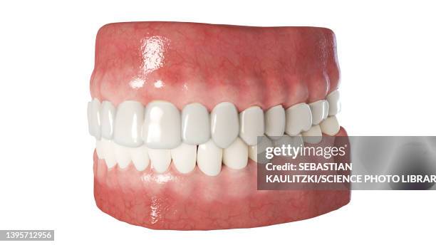 clear dental aligner, illustration - invisalign stock illustrations