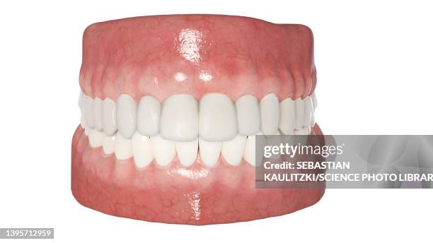 clear dental aligner, illustration - invisalign stock illustrations