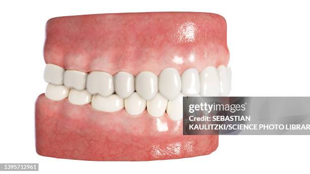 clear dental aligner, illustration - invisalign stock illustrations