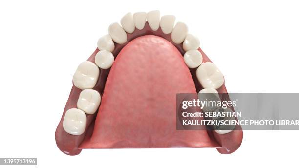 overcrowded teeth, illustration - heavy stock illustrations