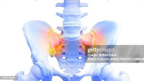 ilustrações, clipart, desenhos animados e ícones de painful sacroiliac joint, illustration - virilha humana