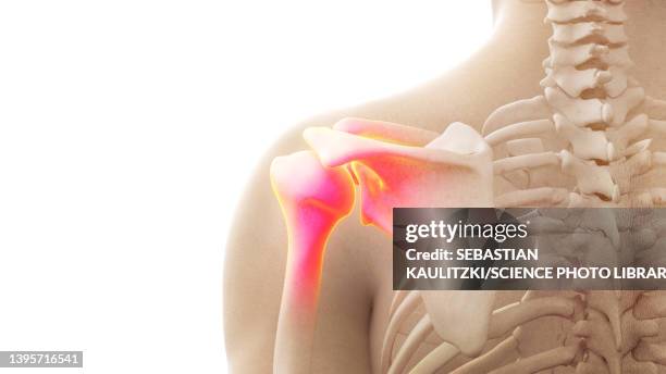 painful shoulder, illustration - shoulder bone stock illustrations