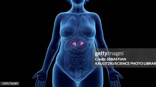 bildbanksillustrationer, clip art samt tecknat material och ikoner med obese woman's adrenal glands, illustration - adrenal gland