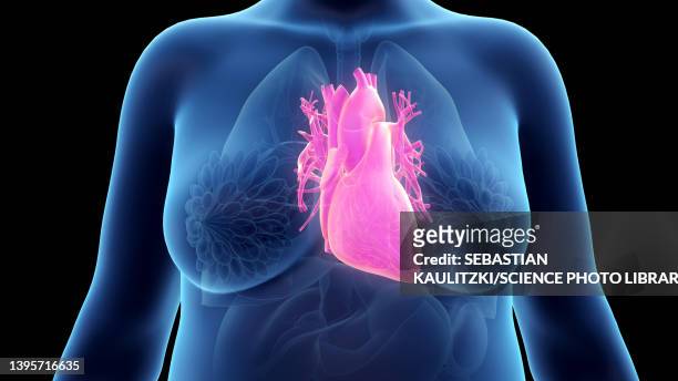 ilustraciones, imágenes clip art, dibujos animados e iconos de stock de obese woman's heart, illustration - heart ventricle