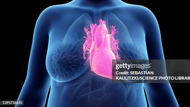 bildbanksillustrationer, clip art samt tecknat material och ikoner med obese woman's heart, illustration - heart ventricle