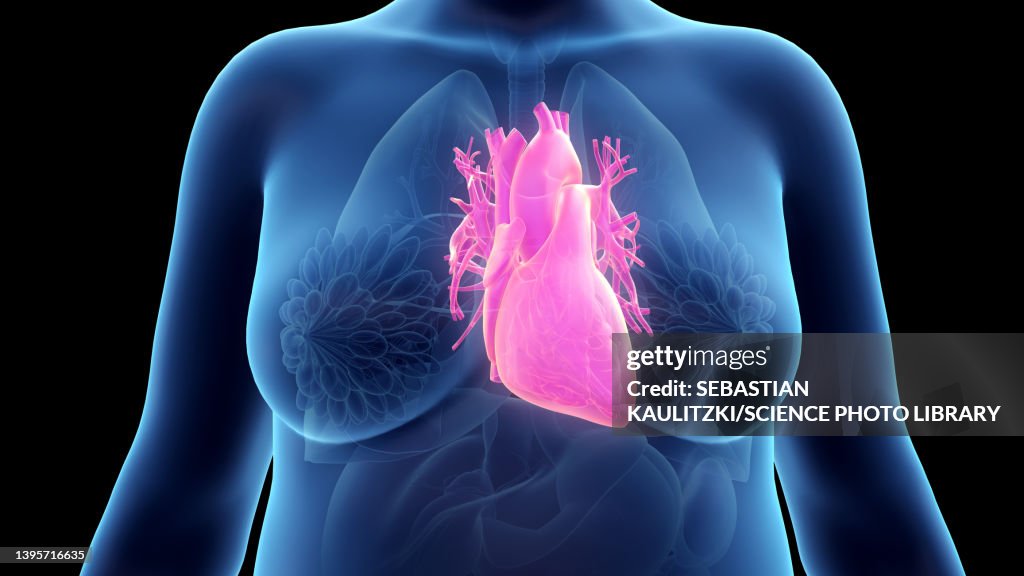 Obese woman's heart, illustration