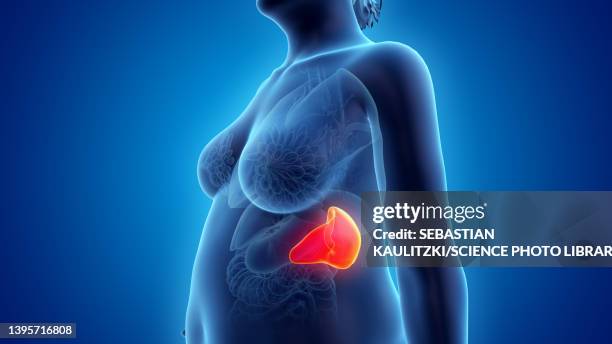 obese woman's spleen, illustration - spleen stock illustrations