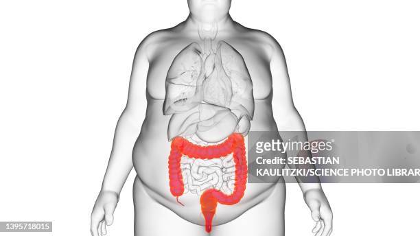 obese man's colon, illustration - sigmoid colon stock illustrations